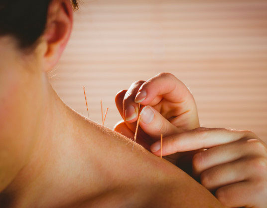 Why Hiring A Professional Acupuncturist Is Necessary?