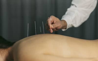 What To Ask Your Acupuncturist Before Beginning Treatment