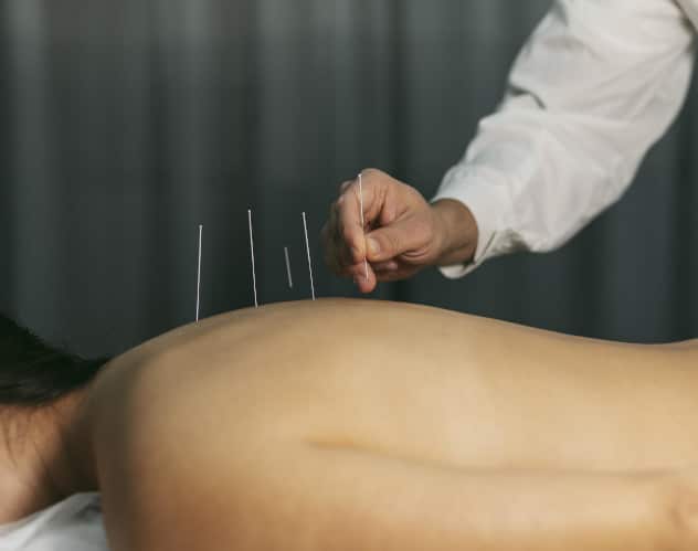 acupuncture process