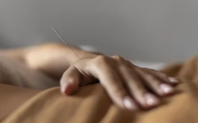 Acupuncture for Pain and When to Consider It