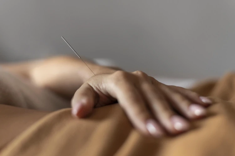 Acupuncture for Pain and When to Consider It