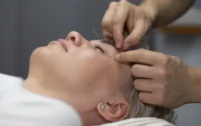 Facial Acupuncture vs. Botox and Cosmetic Surgery: Navigating the Path to Timeless Beauty